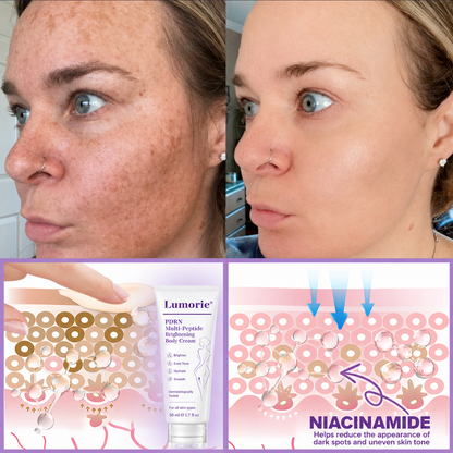 𝐋𝐮𝐦𝐨𝐫𝐢𝐞® PDRN💎 Multi-Peptide Massaging Body Roller Cream- Anti-aging, Hydrating, Skin Firming & Lifting, Skin Repair, Even Tone, Acne and Dark Spot Treatment, Wart and Mole Removal, and Psoriasis Relief.