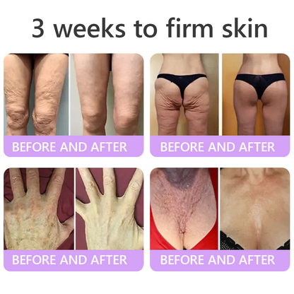 𝐋𝐮𝐦𝐨𝐫𝐢𝐞® PDRN💎 Multi-Peptide Massaging Body Roller Cream- Anti-aging, Hydrating, Skin Firming & Lifting, Skin Repair, Even Tone, Acne and Dark Spot Treatment, Wart and Mole Removal, and Psoriasis Relief.
