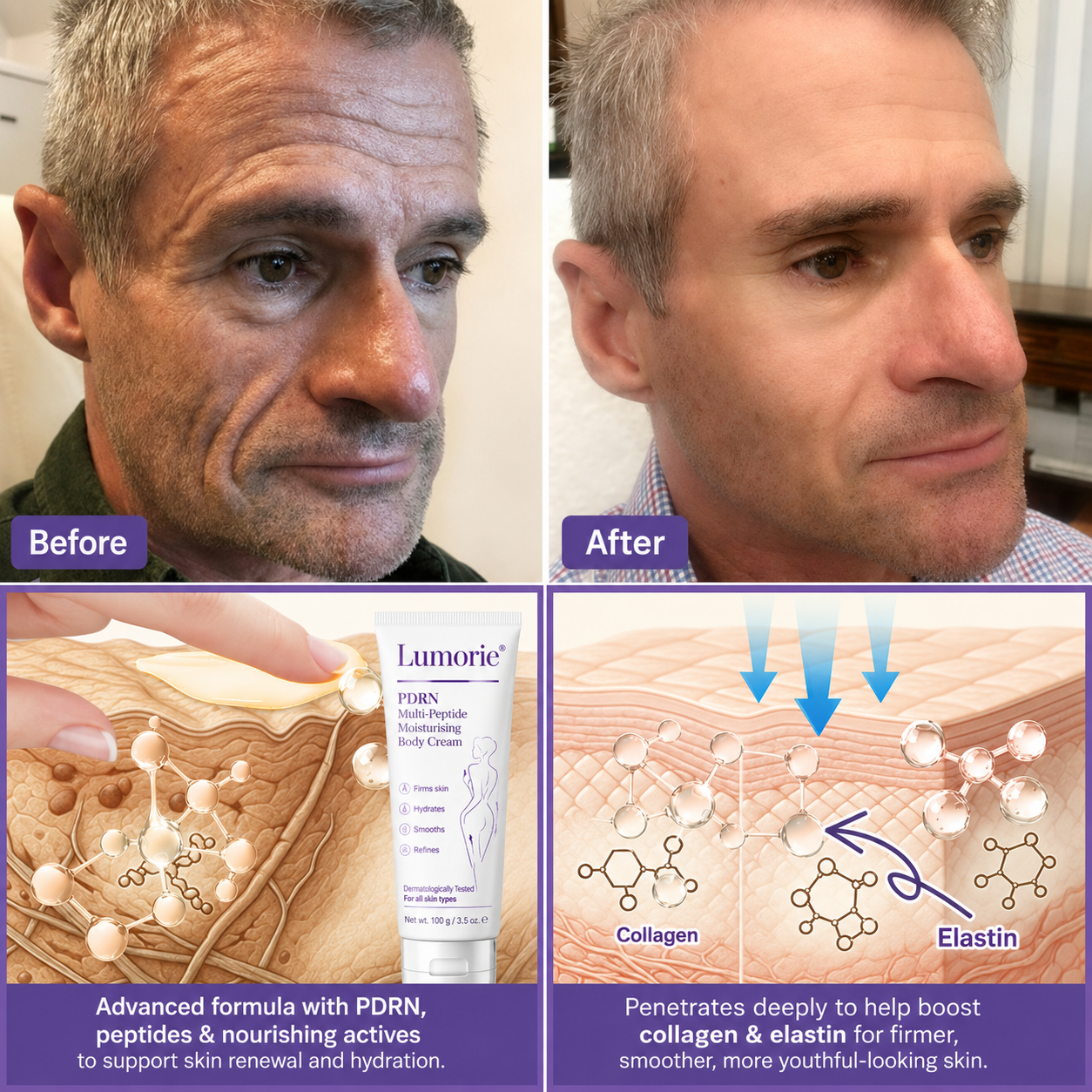 𝐋𝐮𝐦𝐨𝐫𝐢𝐞® PDRN💎 Multi-Peptide Massaging Body Roller Cream- Anti-aging, Hydrating, Skin Firming & Lifting, Skin Repair, Even Tone, Acne and Dark Spot Treatment, Wart and Mole Removal, and Psoriasis Relief.